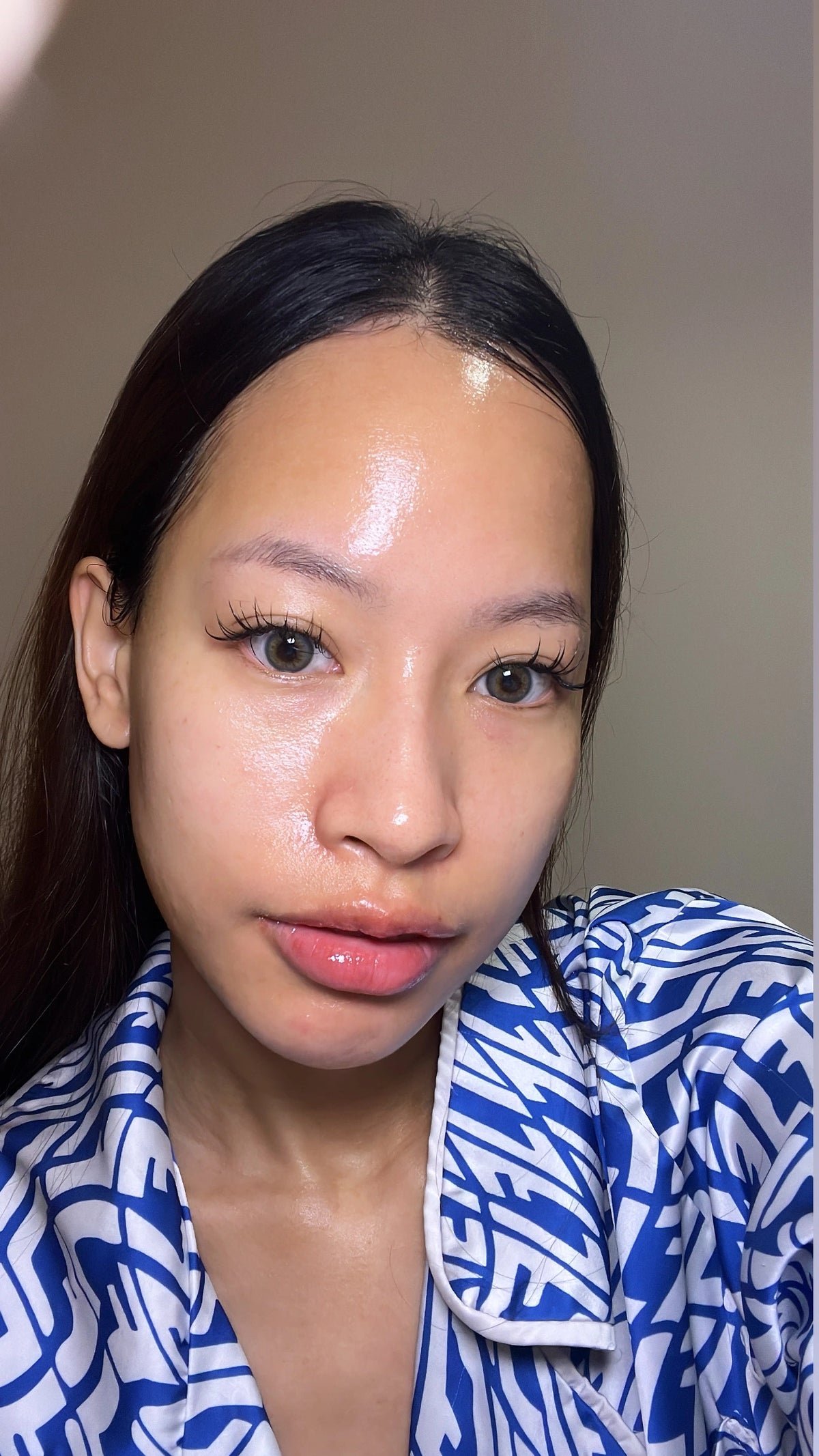 Skin after eight weeks on the protocol